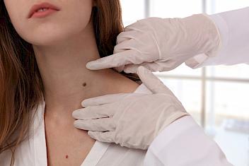 Dermatologist examining a mole on a woman's neck